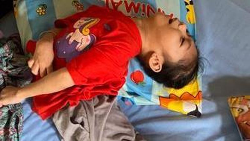kisah-perjuangan-andini-tangani-cerebral-palsy-dan-gizi-buruk