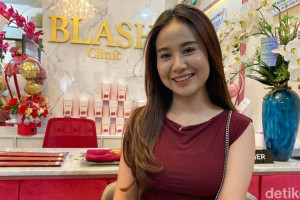 mayang-lucyana-tekankan-perawatan-diri-sebagai-investasi-penting